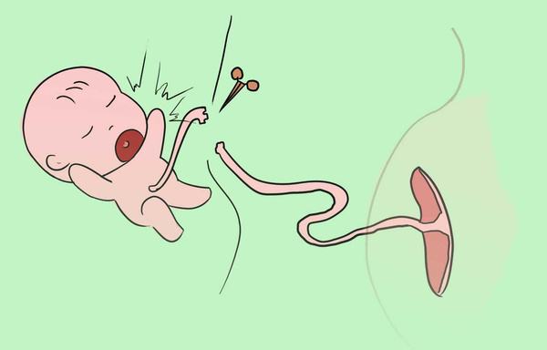 超声91视频污下载之新生儿脐带护理你做对了吗 超声91视频污下载之新生儿脐带护理你做对了吗